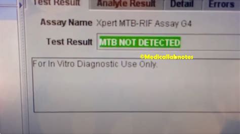 mtb not detected result